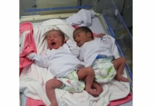 이스라엘 공습 중 가자지구에서 태어난 쌍둥이 자매 [사마르 아부 엘로프 SNS 캡처]